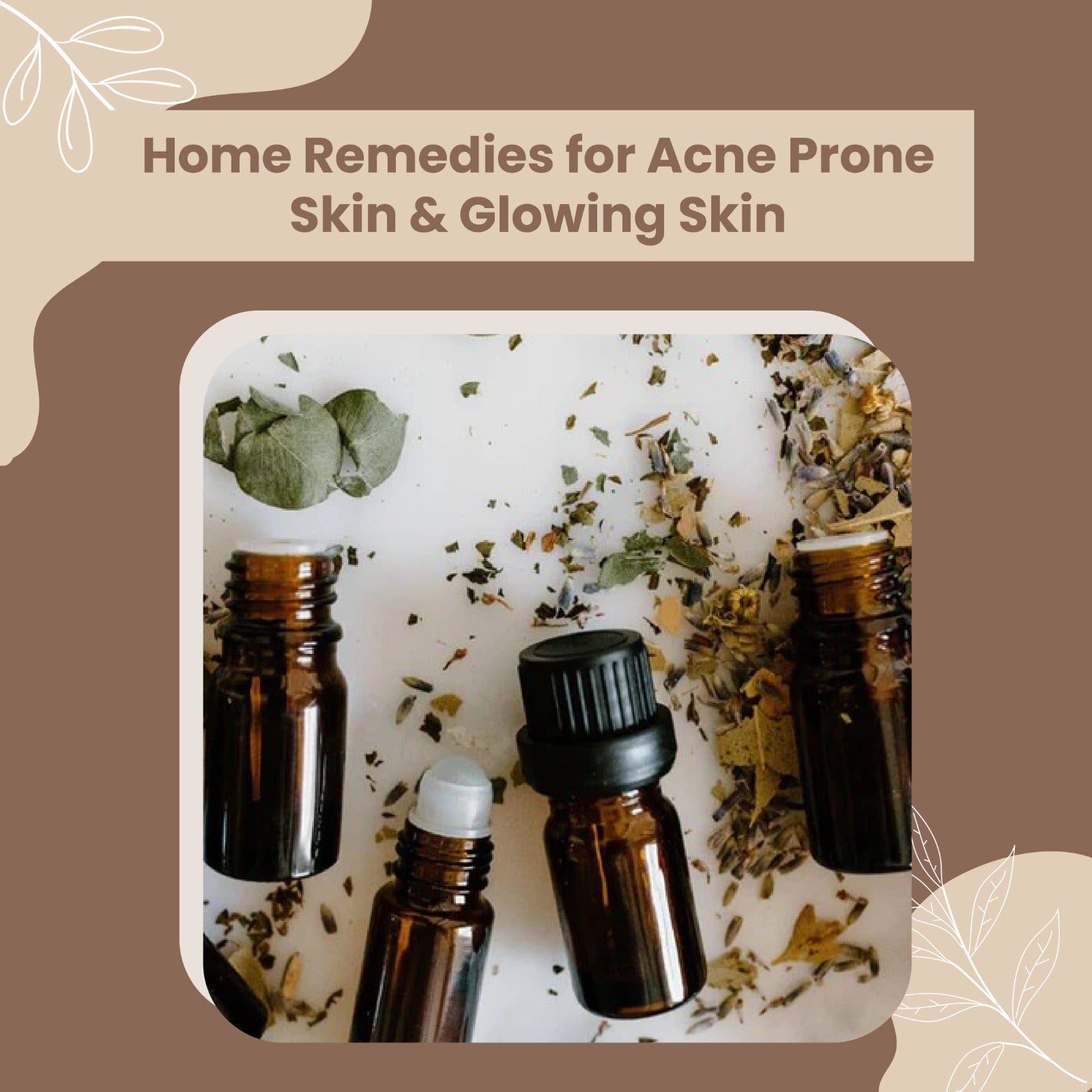 Home Remedies for Acne Prone Skin & Glowing Skin